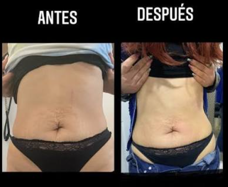 Producto reseñado