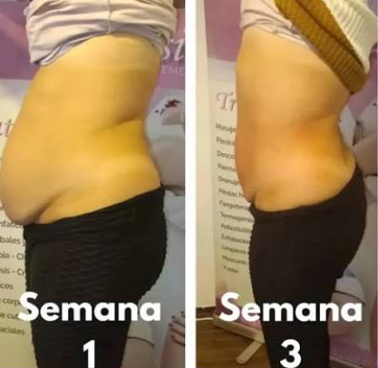 Producto reseñado